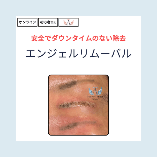 エンジェルリムーバル(オンライン)